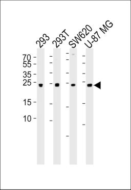 Western blot analysis of lysates from 293, 293T, SW620, U-87 MG cell line (from left to right), using UCHL3 Antibody (C209) at 1:1000 at each lane.