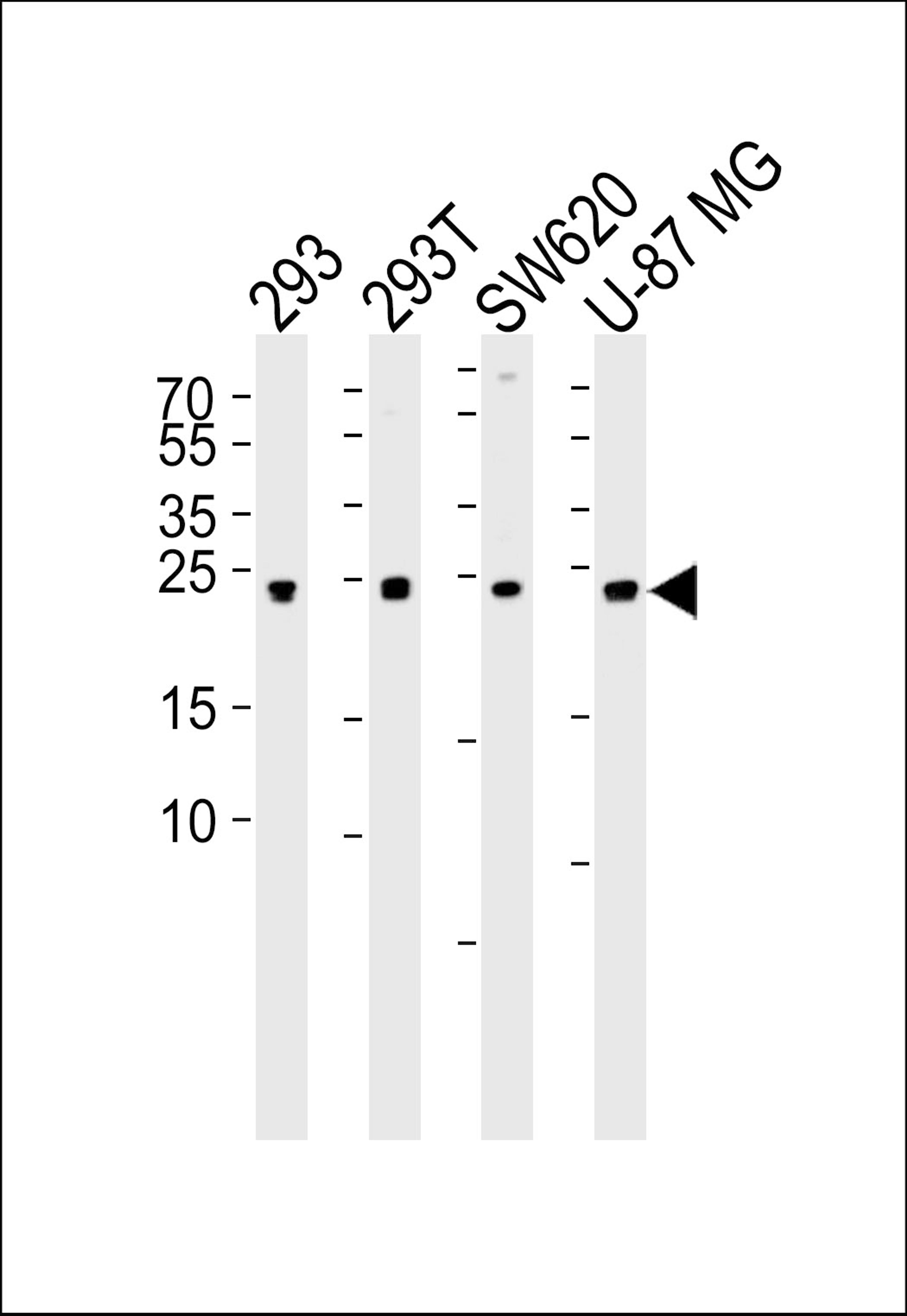 Western blot analysis of lysates from 293, 293T, SW620, U-87 MG cell line (from left to right), using UCHL3 Antibody (C209) at 1:1000 at each lane.