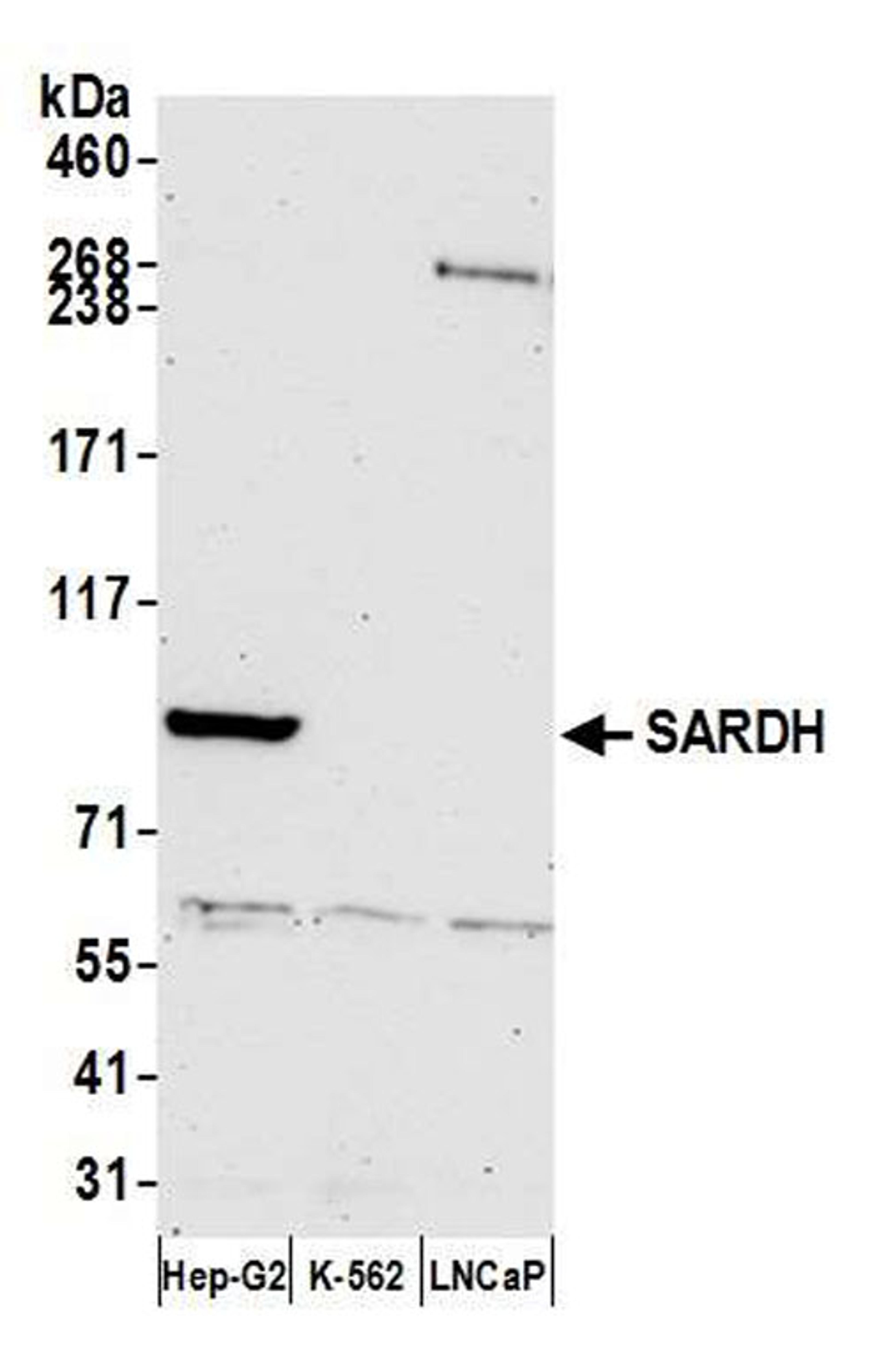 Detection of human SARDH by WB.