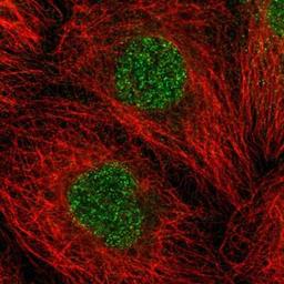 Immunocytochemistry/Immunofluorescence: Themis Antibody [NBP1-90802] - Staining of human cell line A-431 shows positivity in nucleus.