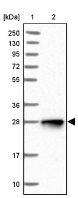 Western Blot: NUDT8 Antibody [NBP1-81908] - Lane 1: Marker [kDa] 250, 130, 95, 72, 55, 36, 28, 17, 10<br/>Lane 2: Human cell line RT-4