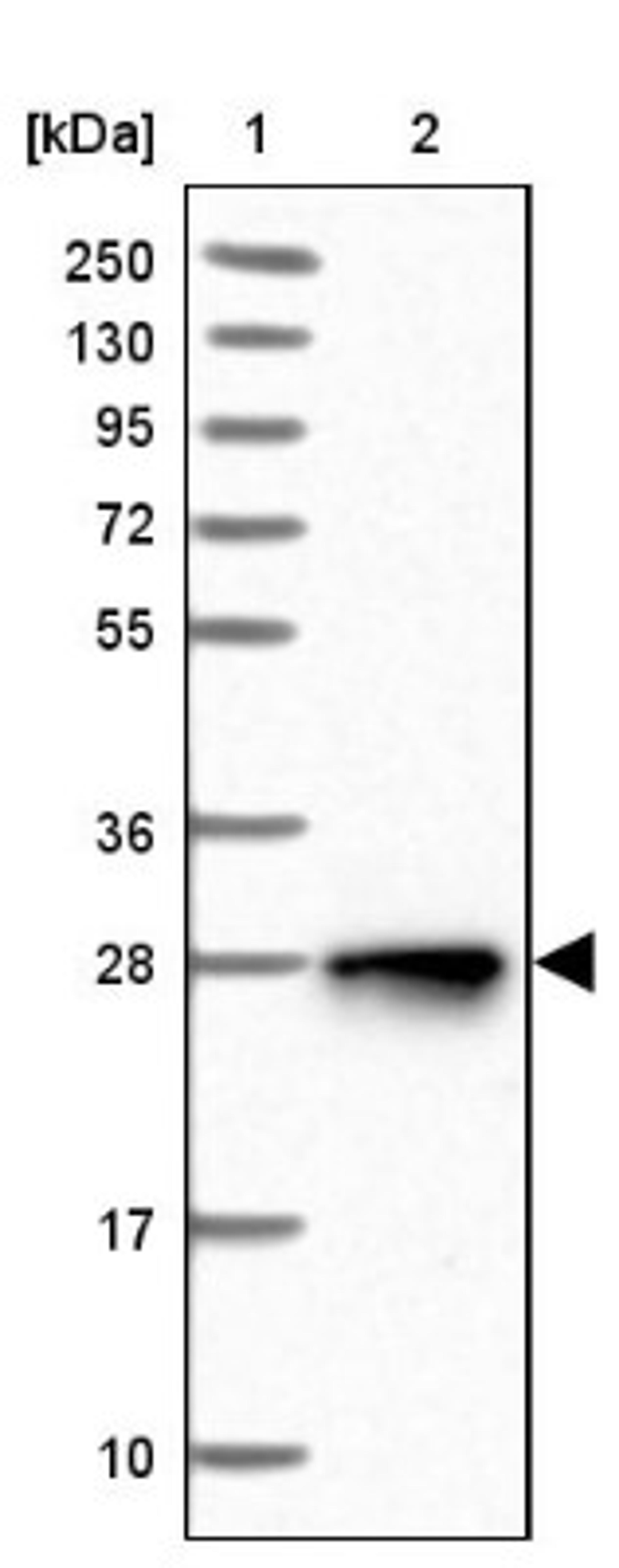 Western Blot: NUDT8 Antibody [NBP1-81908] - Lane 1: Marker [kDa] 250, 130, 95, 72, 55, 36, 28, 17, 10<br/>Lane 2: Human cell line RT-4