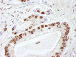 Detection of human DNA-PKcs by immunohistochemistry.