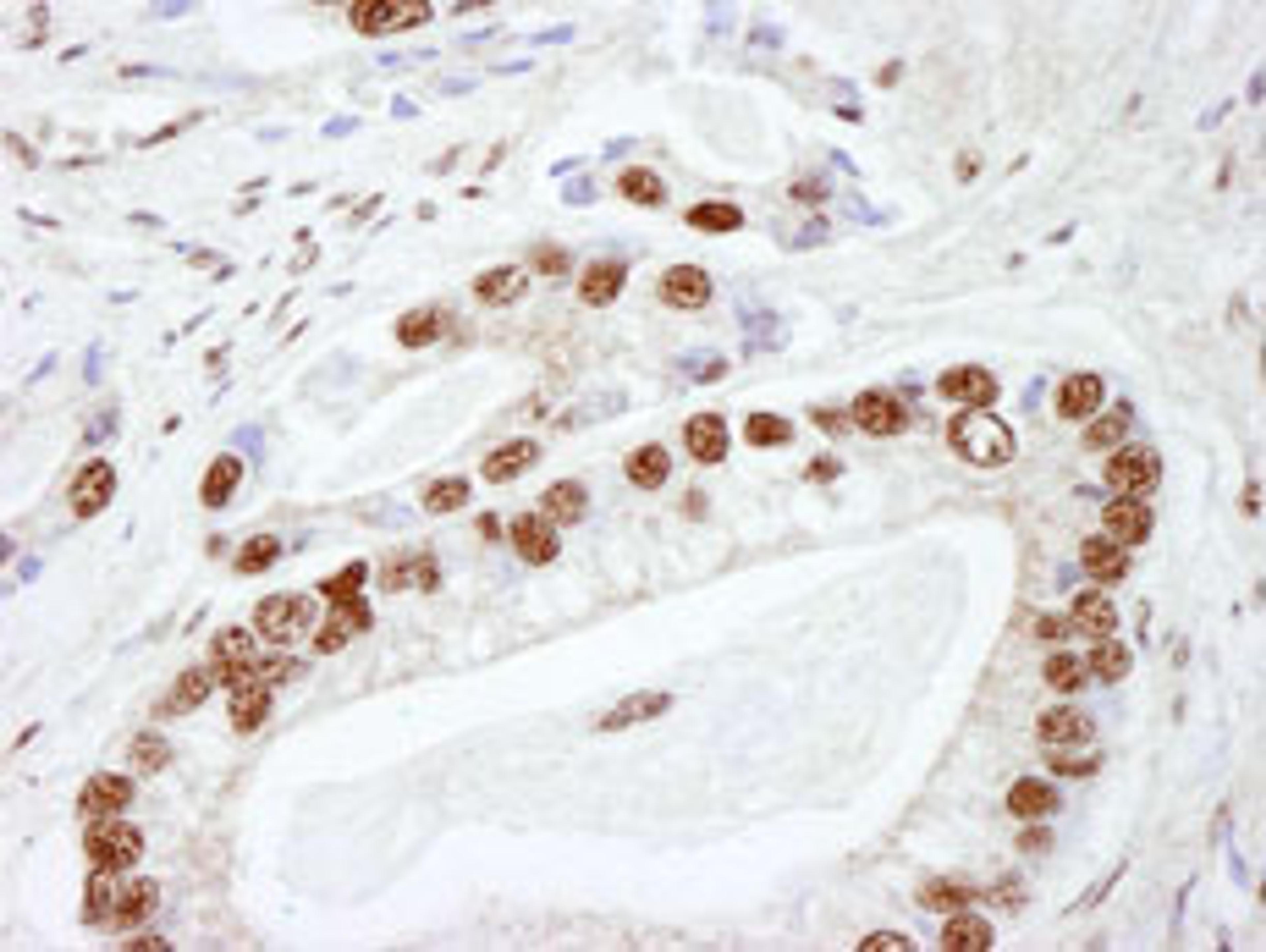 Detection of human DNA-PKcs by immunohistochemistry.