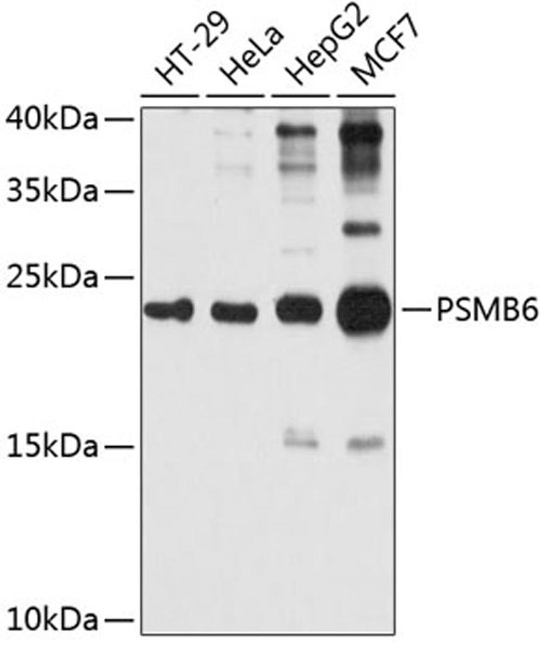 Western blot - PSMB6 antibody (A4053)