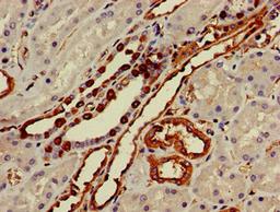 Immunohistochemistry of paraffin-embedded human kidney tissue using CSB-PA884421LA01HU at dilution of 1:100