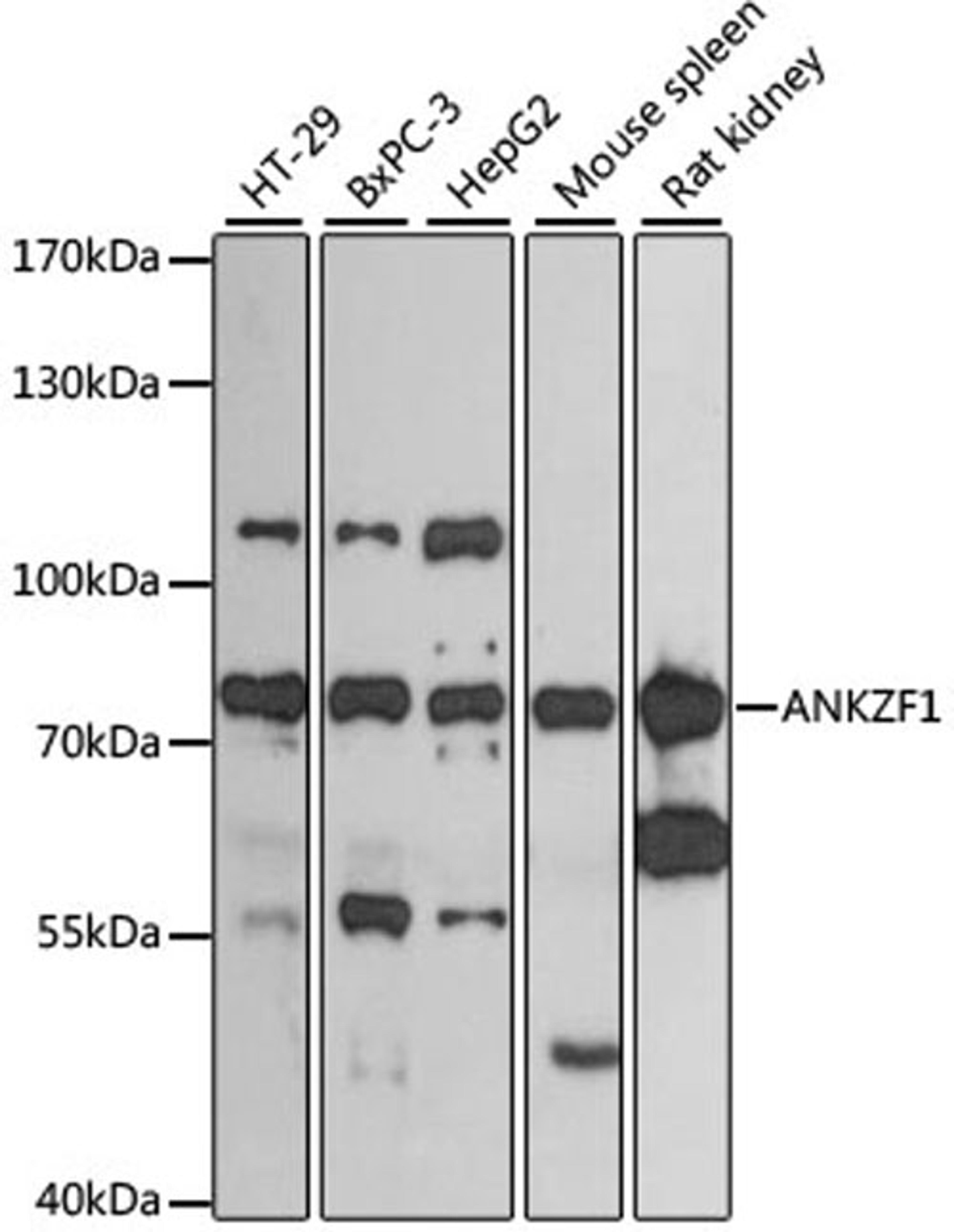 Western blot - ANKZF1 antibody (A13786)