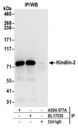 Detection of human Kindlin-2 by western blot of immunoprecipitates.