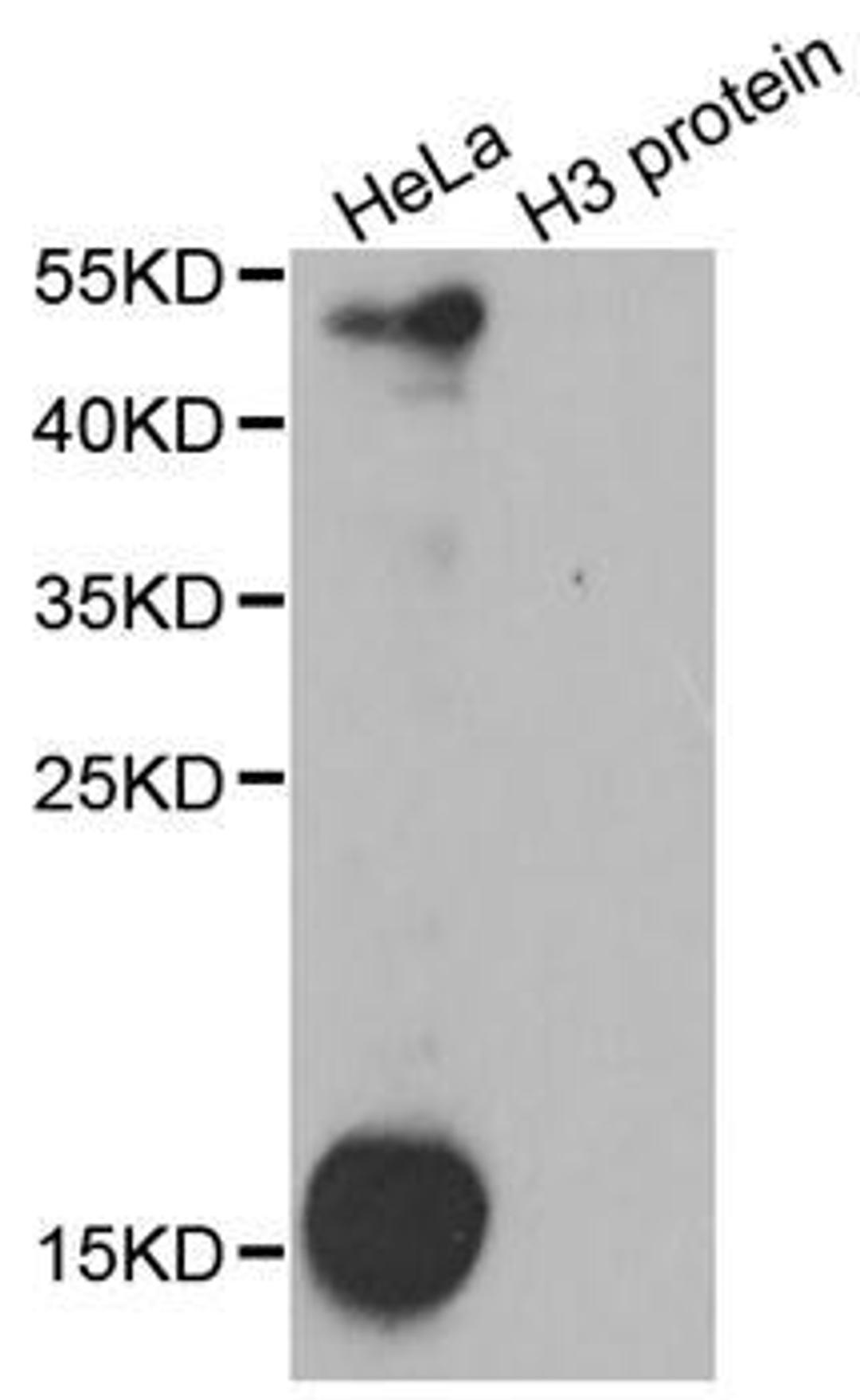 Western blot analysis of extracts of HeLa cell line and H3 protein purified from E.coli using pan-Kme2 antibody