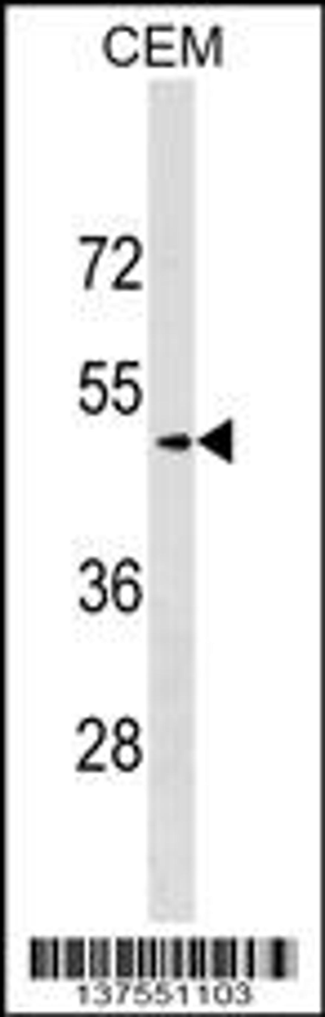 Western blot analysis in CEM cell line lysates (35ug/lane).