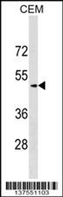 Western blot analysis in CEM cell line lysates (35ug/lane).