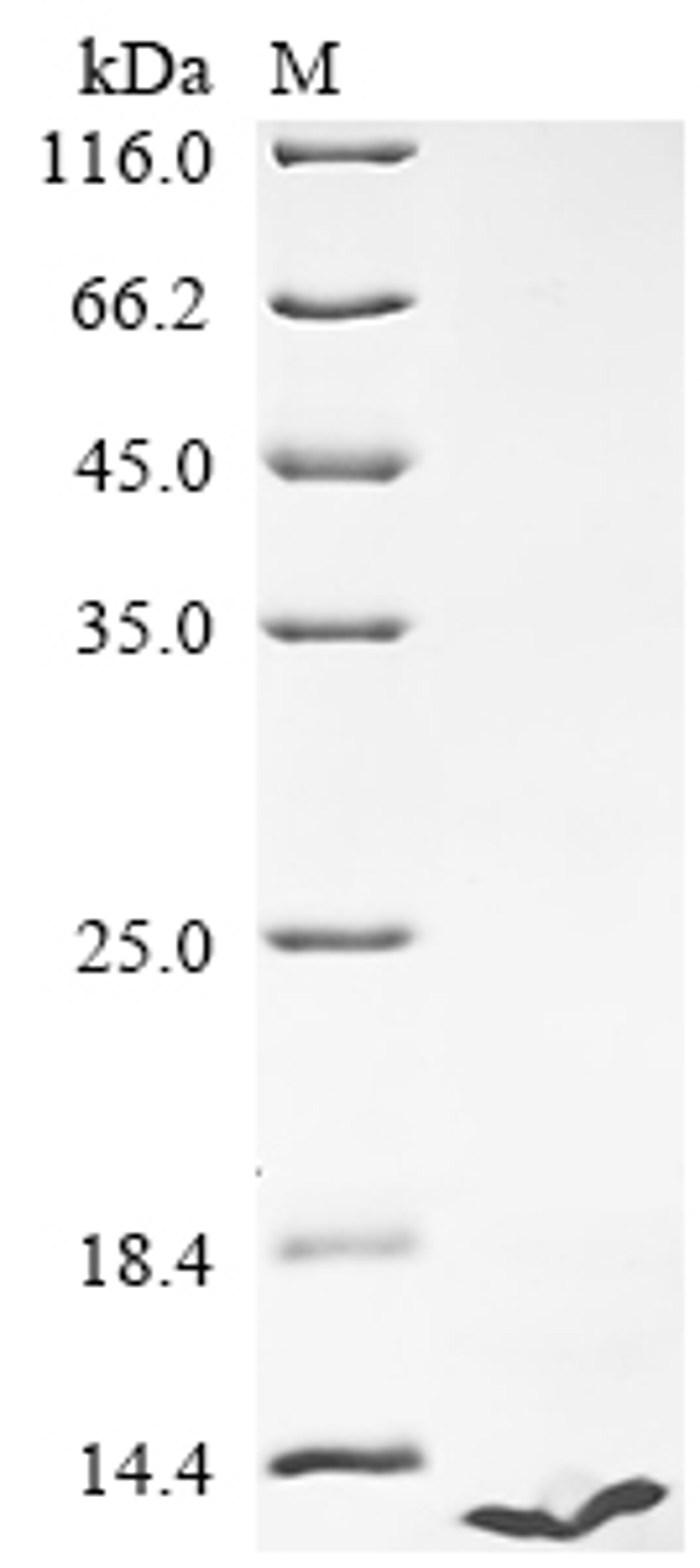 (Tris-Glycine gel) Discontinuous SDS-PAGE (reduced) with 5% enrichment gel and 15% separation gel.