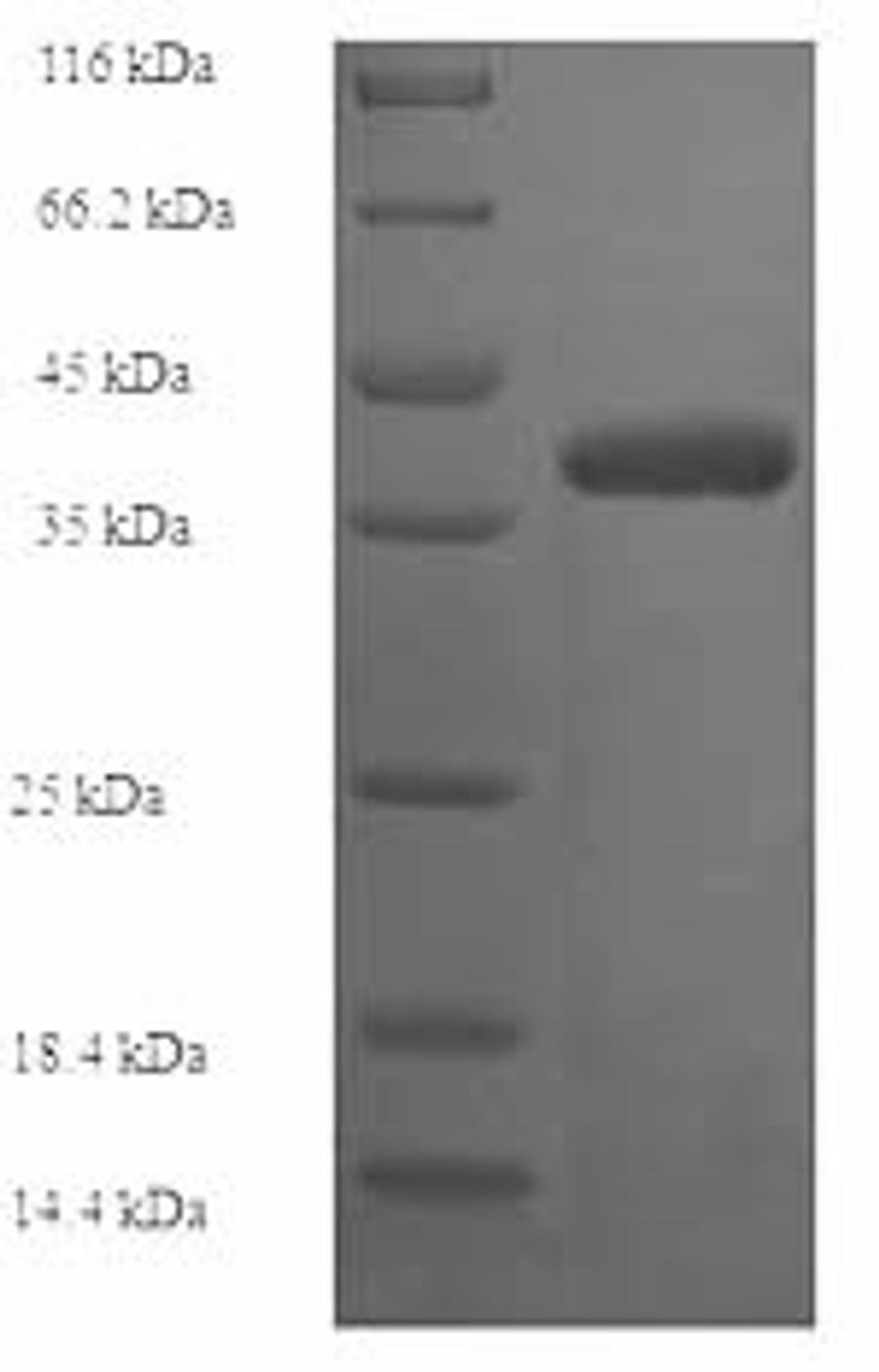 (Tris-Glycine gel) Discontinuous SDS-PAGE (reduced) with 5% enrichment gel and 15% separation gel.