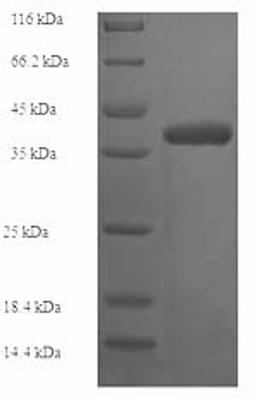 (Tris-Glycine gel) Discontinuous SDS-PAGE (reduced) with 5% enrichment gel and 15% separation gel.