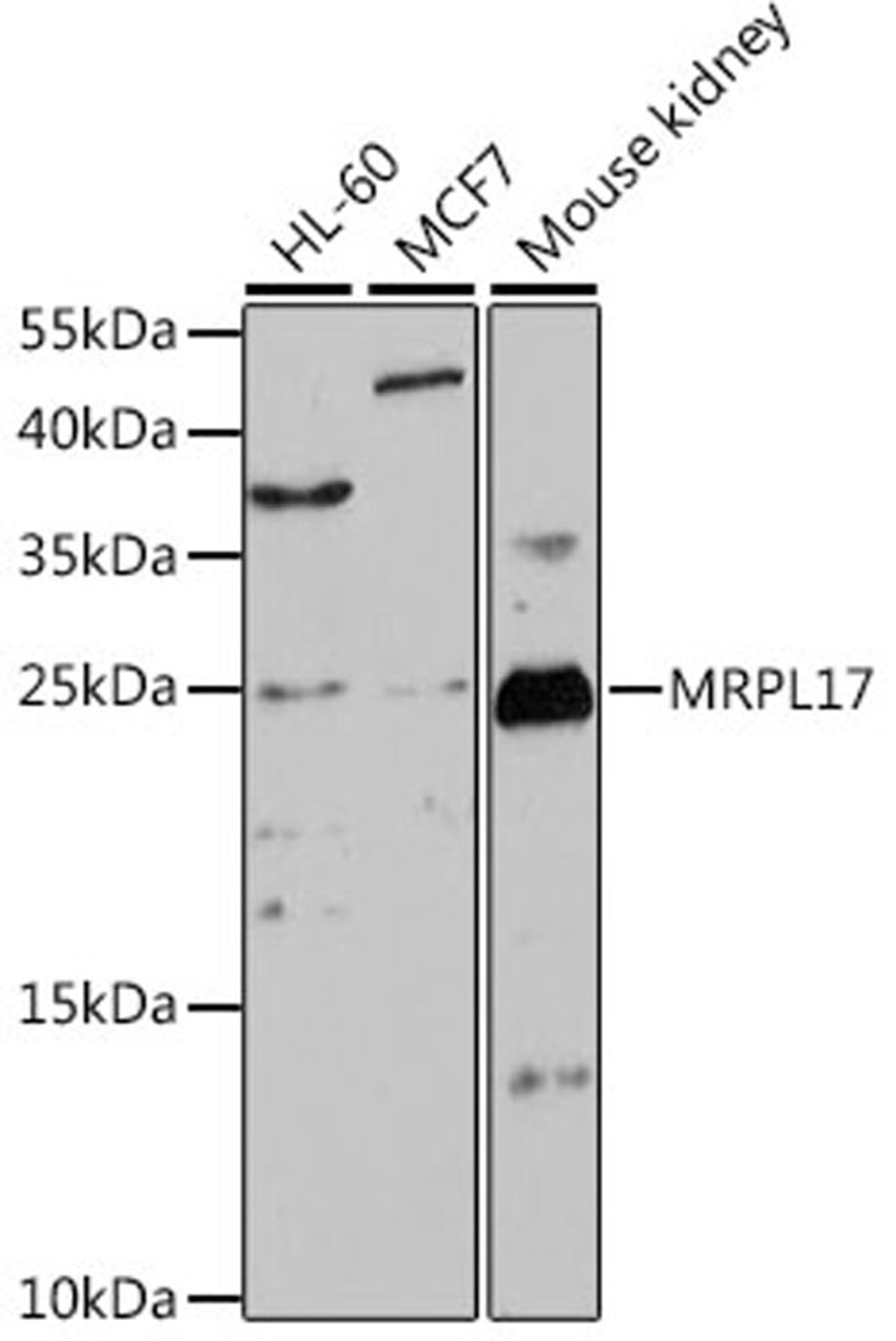 Western blot - MRPL17 antibody (A15603)