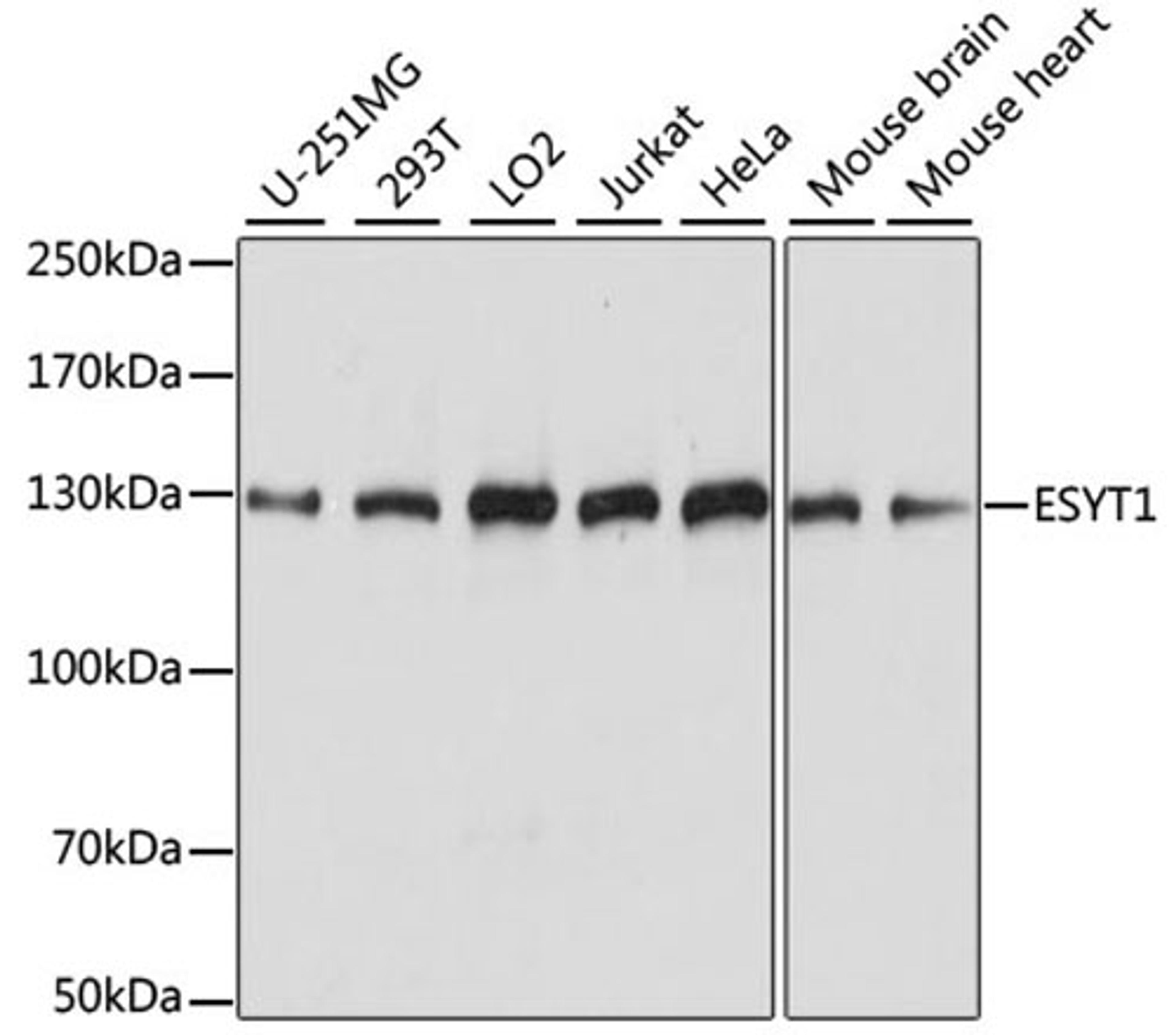 Western blot - ESYT1 antibody (A15410)