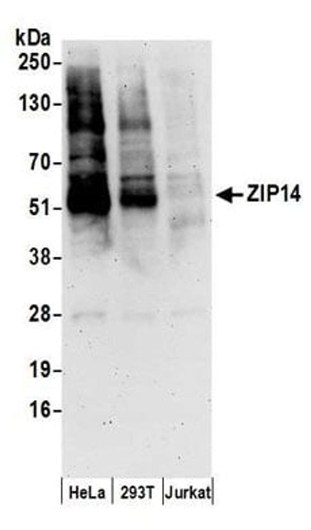 Detection of human ZIP14 by western blot.