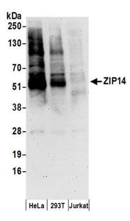 Detection of human ZIP14 by western blot.