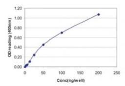 ELISA: Influenza A H1N1 Nucleoprotein Antibody [NB100-56570] - Influenza A standard curve. Influenza A monclonal antibody, clone 2F205 was used as the capture antibody. Influenza A polyclonal antibody (NB100-56570) was used as the detection antibody. Recombinant Influenza A Nucleoprotein was used as the protein standard. Researchers should empirically determine the optimal antibody concentrations for their ELISA assays.