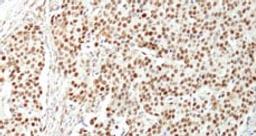 Detection of human NUCKS by immunohistochemistry.