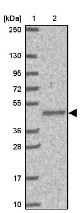 Western Blot: SLC44A4 Antibody [NBP2-33707] - Lane 1: Marker [kDa] 250, 130, 95, 72, 55, 36, 28, 17, 10<br/>Lane 2: Human cell line RT-4