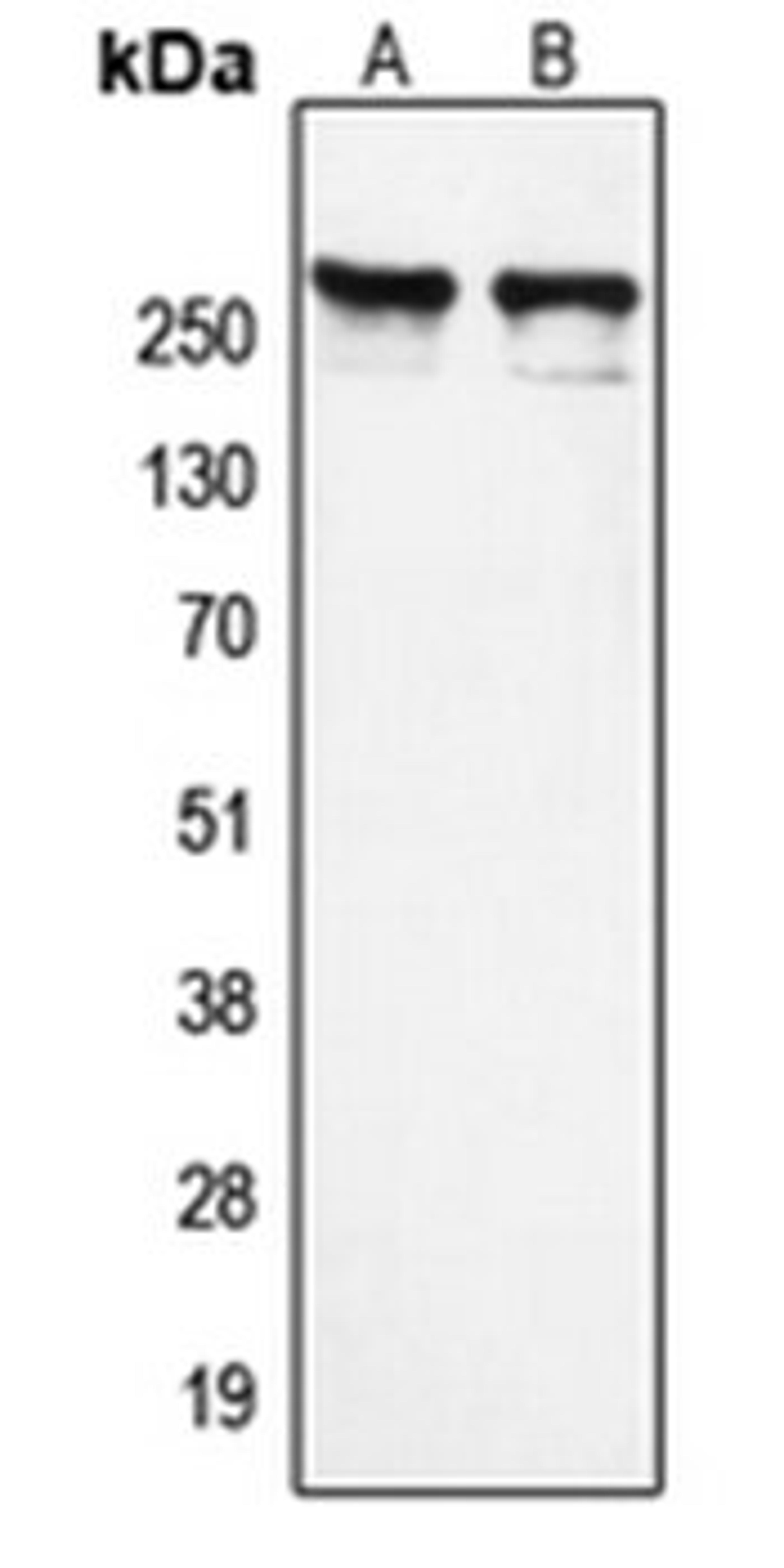 Western blot analysis of K562 (Lane 1), HeLa (Lane 2) whole cell lysates using NCOR1 antibody