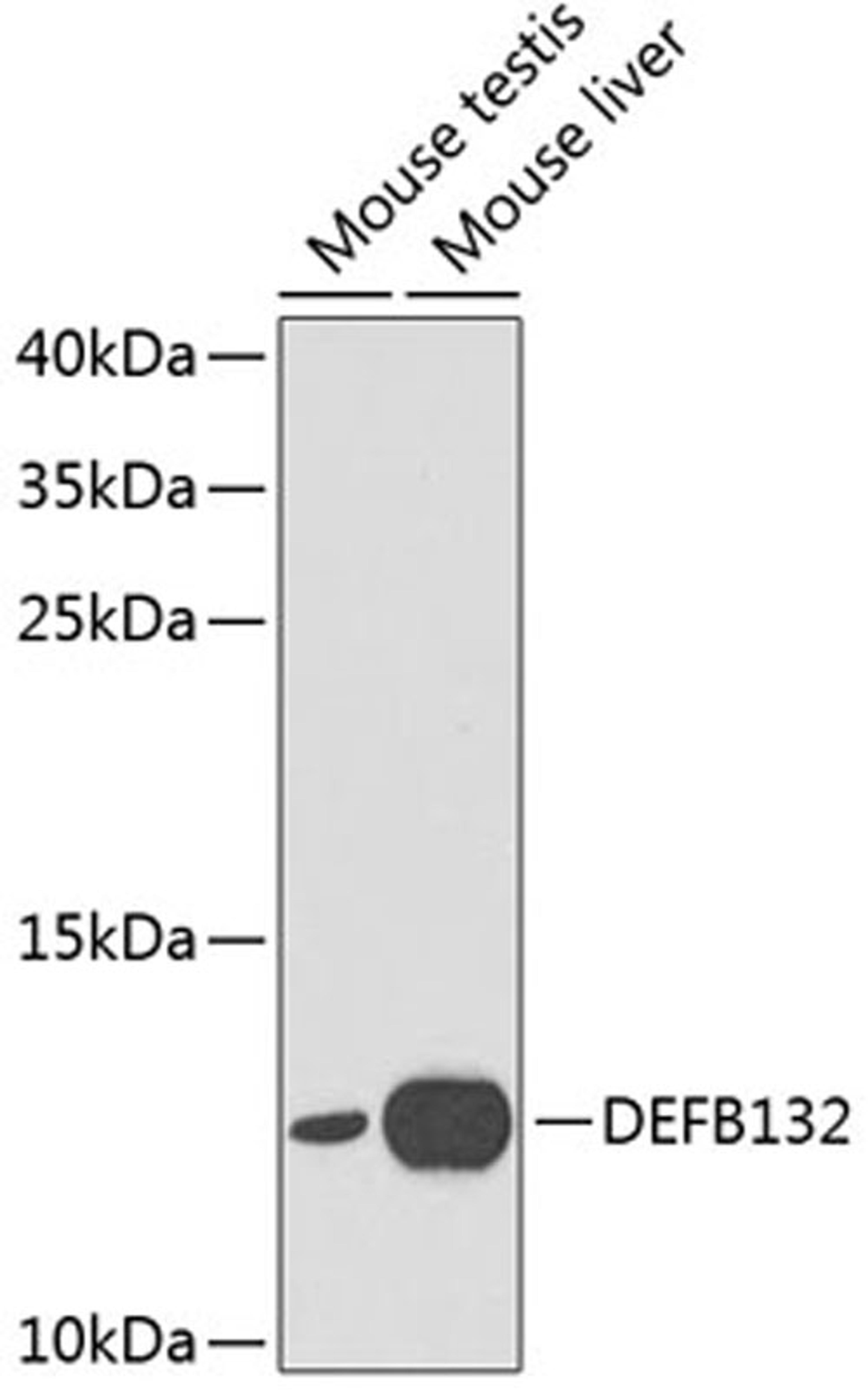 Western blot - DEFB132 antibody (A1074)