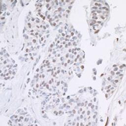 Detection of human ARID1B by immunohistochemistry.