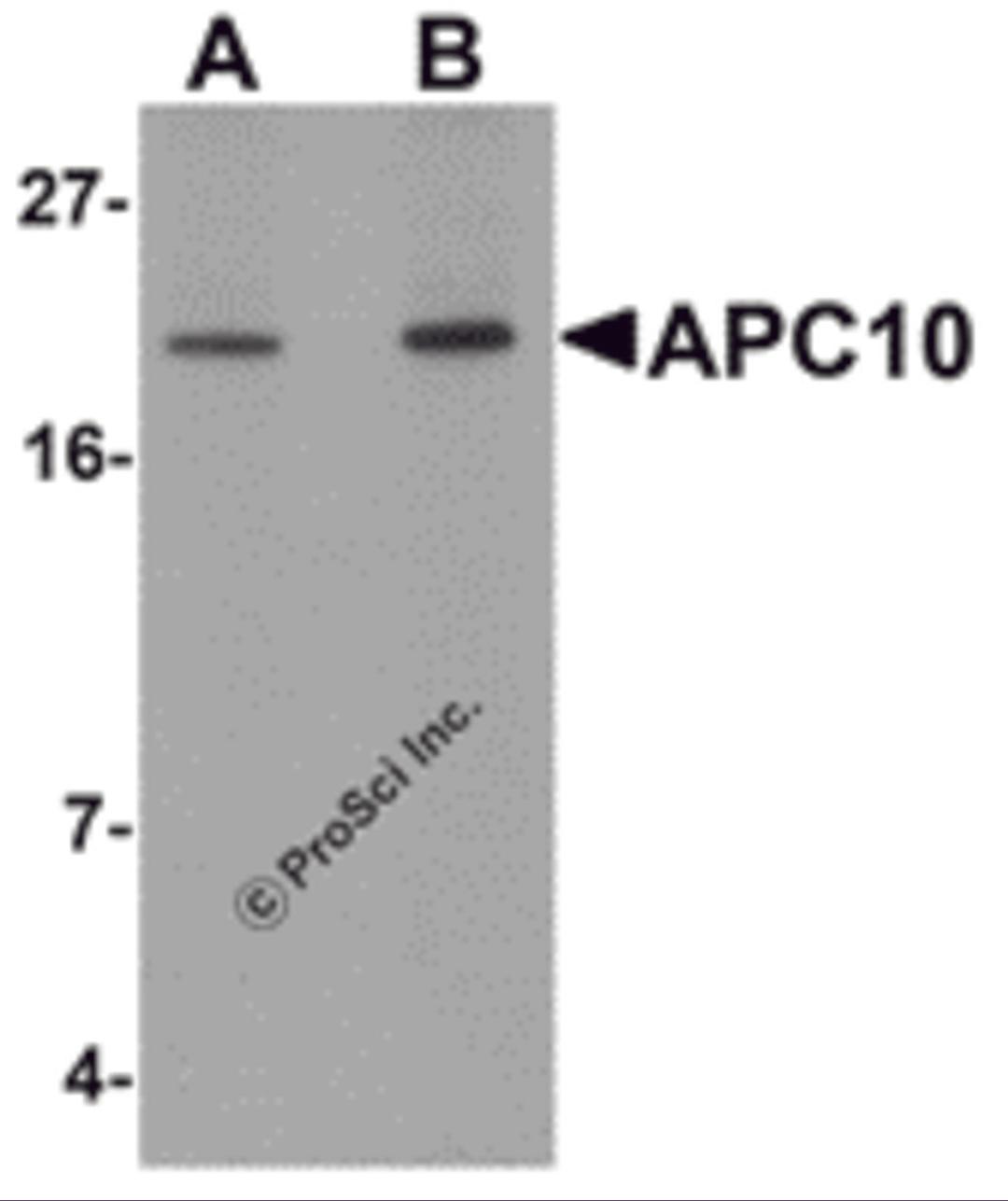 Western blot analysis of APC10 in mouse heart tissue lysate with APC10 antibody at (A) 1 and (B) 2 &#956;g/mL.