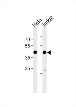 Western blot analysis in Hela and Jurkat cell line lysates (35ug/lane).