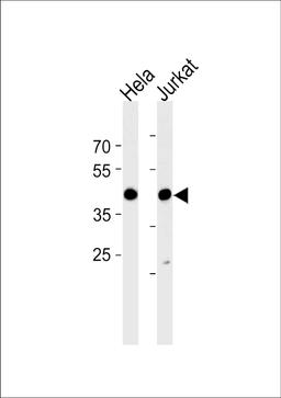 Western blot analysis in Hela and Jurkat cell line lysates (35ug/lane).