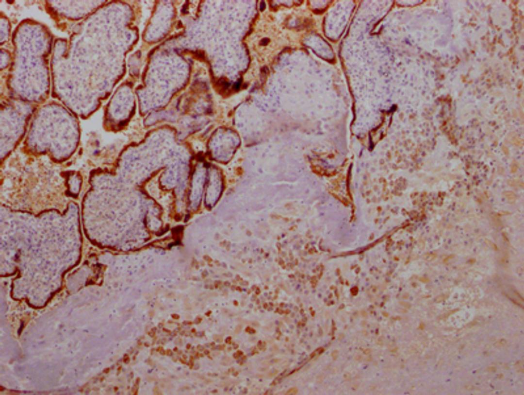 IHC image of CSB-RA891358A0HU diluted at 1:100 and staining in paraffin-embedded human placenta tissue performed on a Leica BondTM system. After dewaxing and hydration, antigen retrieval was mediated by high pressure in a citrate buffer (pH 6.0). Section was blocked with 10% normal goat serum 30min at RT. Then primary antibody (1% BSA) was incubated at 4℃ overnight. The primary is detected by a Goat anti-rabbit IgG polymer labeled by HRP and visualized using 0.05% DAB.
