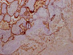 IHC image of CSB-RA891358A0HU diluted at 1:100 and staining in paraffin-embedded human placenta tissue performed on a Leica BondTM system. After dewaxing and hydration, antigen retrieval was mediated by high pressure in a citrate buffer (pH 6.0). Section was blocked with 10% normal goat serum 30min at RT. Then primary antibody (1% BSA) was incubated at 4℃ overnight. The primary is detected by a Goat anti-rabbit IgG polymer labeled by HRP and visualized using 0.05% DAB.
