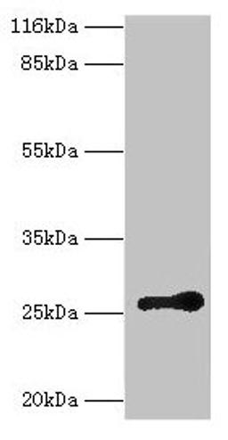 Western blot. All lanes: RAB3C antibody at 2µg/ml + Mouse brain tissue. Secondary. Goat polyclonal to rabbit IgG at 1/10000 dilution. Predicted band size: 26 kDa. Observed band size: 26 kDa