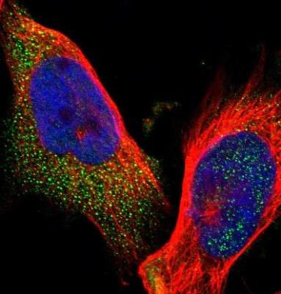 Immunocytochemistry/Immunofluorescence: ELKS Antibody [NBP1-88177] - Staining of human cell line U-251 MG shows positivity in cytoplasm. Antibody staining is shown in green.