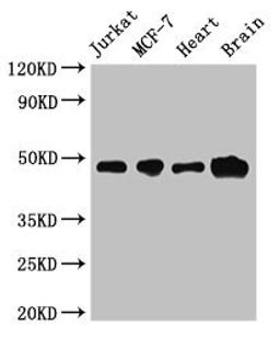 Western Blot. Positive WB detected in: Jurkat whole cell lysate, MCF-7 whole cell lysate, Mouse heart tissue, Mouse brain tissue. All lanes: ZNF645 antibody at 3.2µg/ml. Secondary. Goat polyclonal to rabbit IgG at 1/50000 dilution. Predicted band size: 49 kDa. Observed band size: 49 kDa