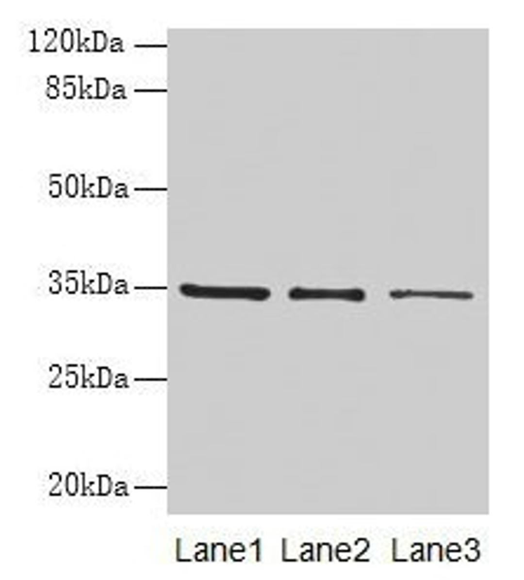 Western blot. All lanes: GDF15 antibody at 4µg/ml. Lane 1: HepG2 whole cell lysate. Lane 2: Human placenta tissue. Lane 3: A549 whole cell lysate. Secondary. Goat polyclonal to rabbit IgG at 1/10000 dilution. Predicted band size: 35 kDa. Observed band size: 35 kDa
