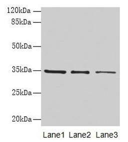 Western blot. All lanes: GDF15 antibody at 4µg/ml. Lane 1: HepG2 whole cell lysate. Lane 2: Human placenta tissue. Lane 3: A549 whole cell lysate. Secondary. Goat polyclonal to rabbit IgG at 1/10000 dilution. Predicted band size: 35 kDa. Observed band size: 35 kDa