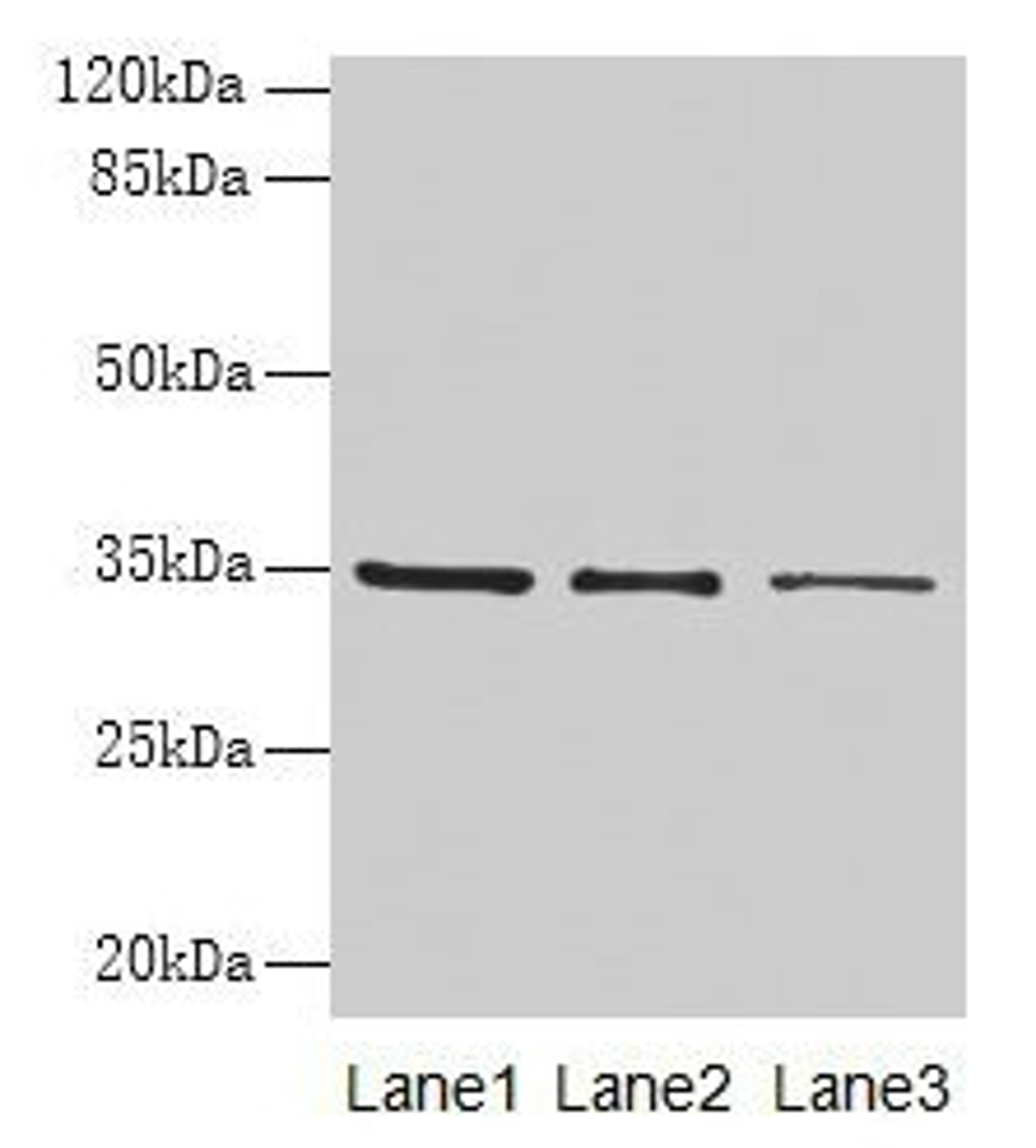 Western blot. All lanes: GDF15 antibody at 4µg/ml. Lane 1: HepG2 whole cell lysate. Lane 2: Human placenta tissue. Lane 3: A549 whole cell lysate. Secondary. Goat polyclonal to rabbit IgG at 1/10000 dilution. Predicted band size: 35 kDa. Observed band size: 35 kDa