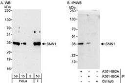 Detection of human SMN1 by western blot and immunoprecipitation.