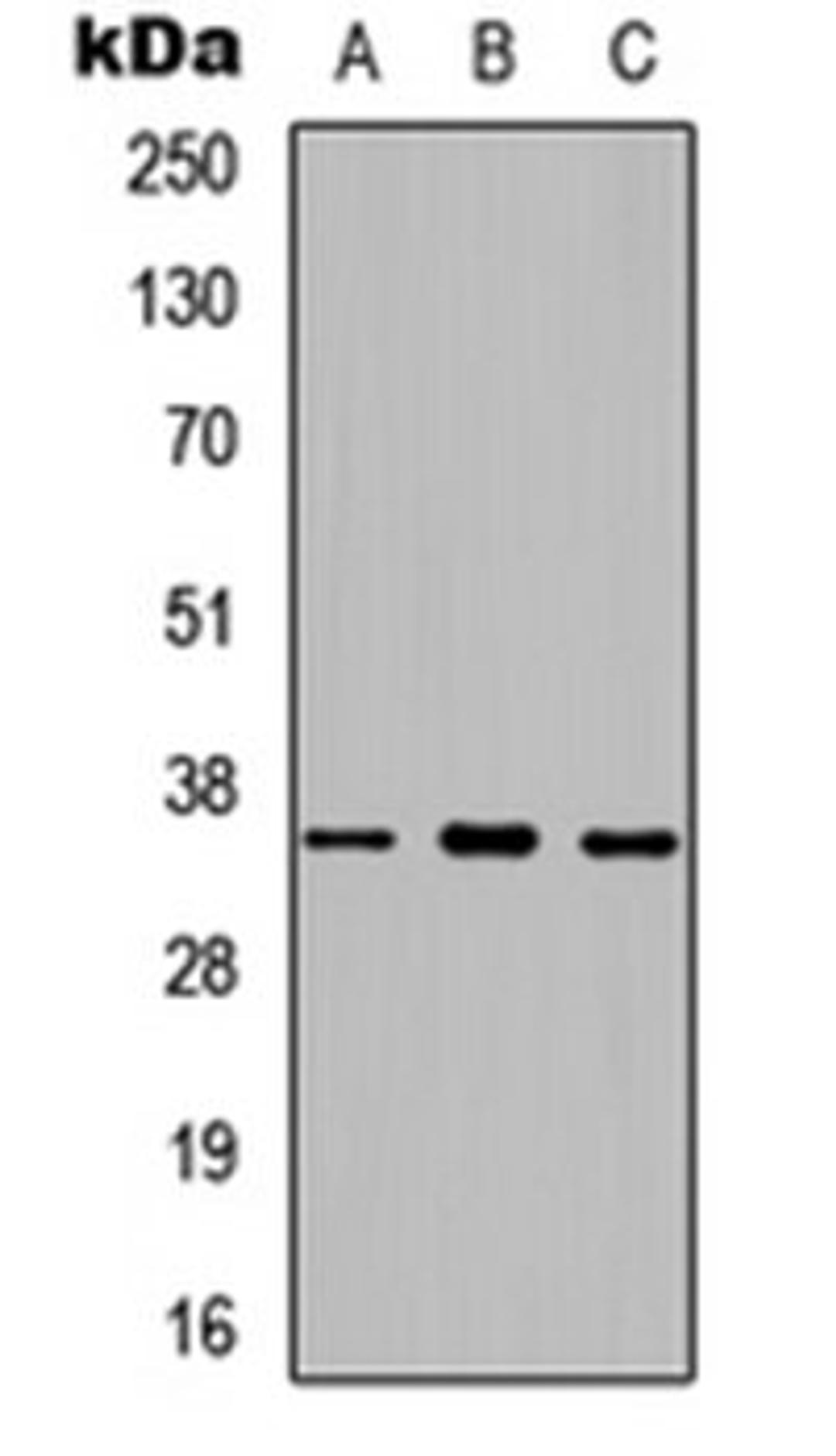 Western blot analysis of HEK293T (Lane 1), Raw264.7 (Lane 2), PC12 (Lane 3) whole cell lysates using Prostasin HC antibody