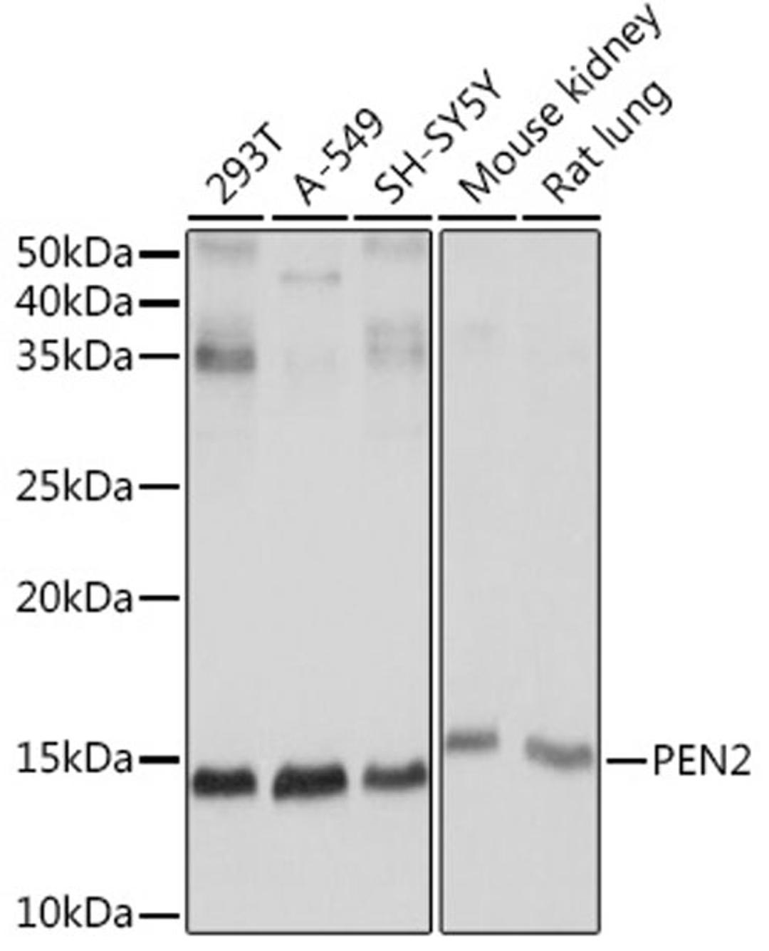 Western blot - PEN2 Rabbit mAb (A8678)