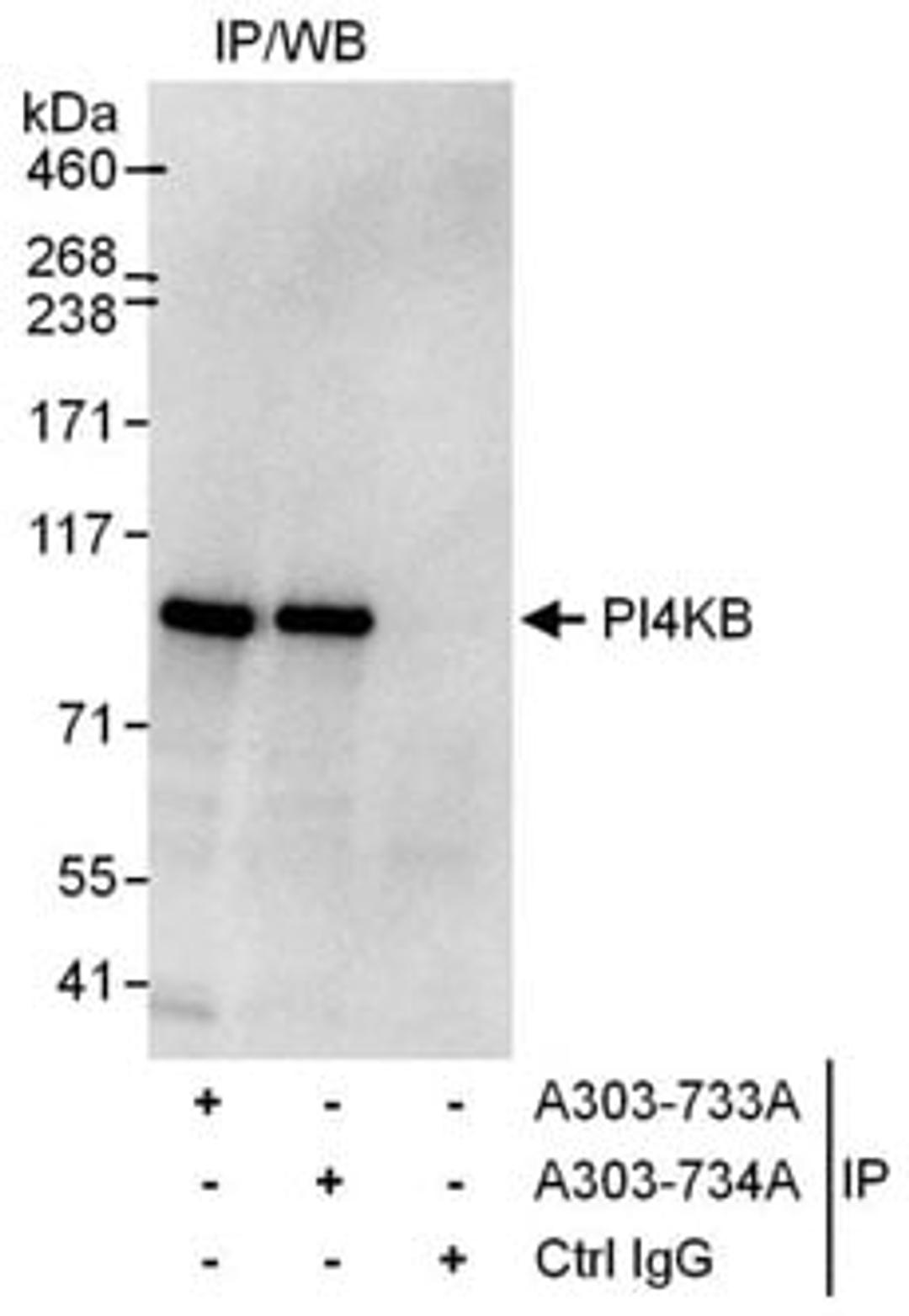 Detection of human PI4KB by western blot of immunoprecipitates.