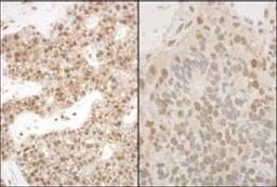 Detection of human and mouse PSMA5 by immunohistochemistry.