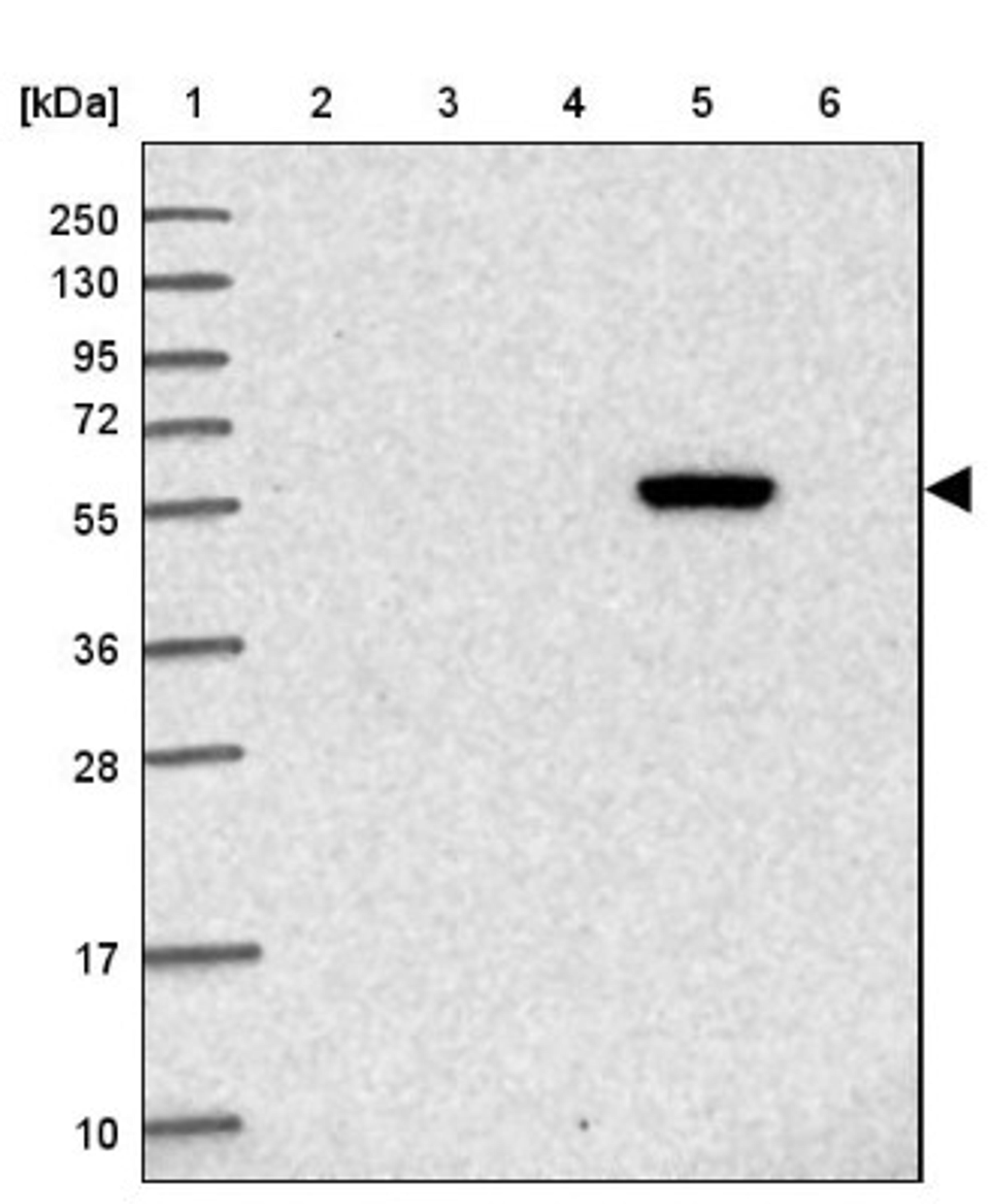 Western Blot: YTHDF3 Antibody [NBP2-38588] - Lane 1: Marker [kDa] 250, 130, 95, 72, 55, 36, 28, 17, 10<br/>Lane 2: RT-4<br/>Lane 3: U-251 MG<br/>Lane 4: Human Plasma<br/>Lane 5: Liver<br/>Lane 6: Tonsil