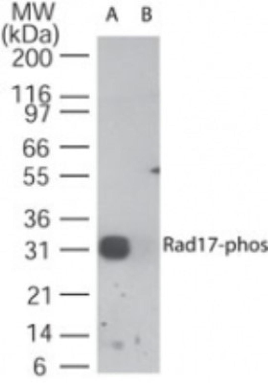 Western Blot: Rad17 [p Ser647] Antibody [NB100-56386] - Analysis of Rad17-phos in A) a partial recombinant protein containing phospho Ser647 and B) the same sequence without the phospho serine, and was blocked using the non-phospho control of the immunizing peptide, using this antibody at 1 ug/ml.