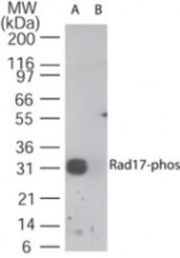 Western Blot: Rad17 [p Ser647] Antibody [NB100-56386] - Analysis of Rad17-phos in A) a partial recombinant protein containing phospho Ser647 and B) the same sequence without the phospho serine, and was blocked using the non-phospho control of the immunizing peptide, using this antibody at 1 ug/ml.