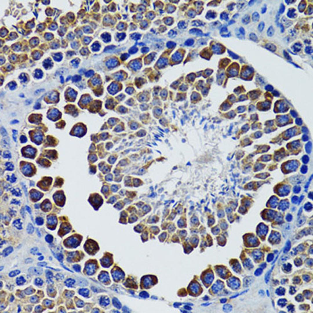 Immunohistochemistry  - HEXA antibody (A12443)