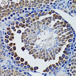 Immunohistochemistry - HEXA antibody (A12443)