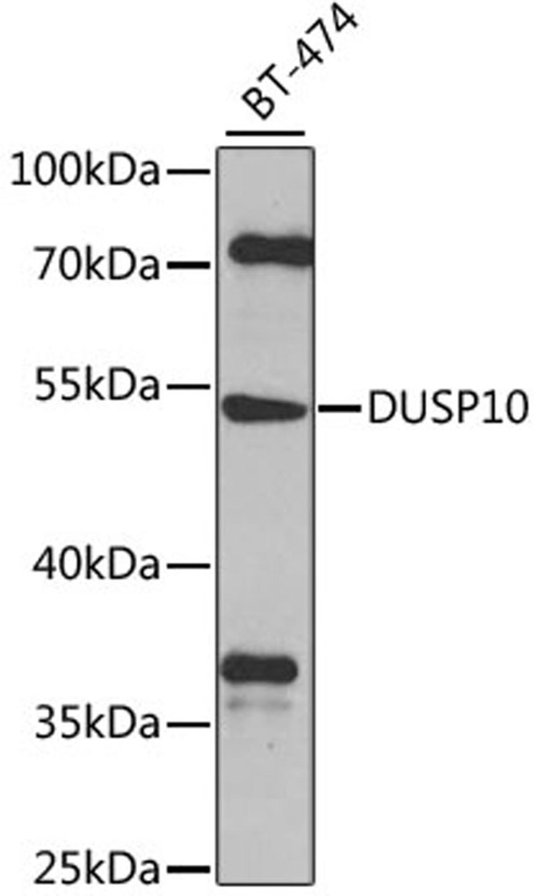 Western blot - DUSP10 antibody (A8748)